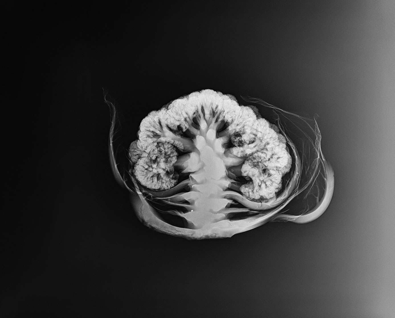 Cauliflower_xray